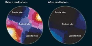 Meditation's effects on the human brain